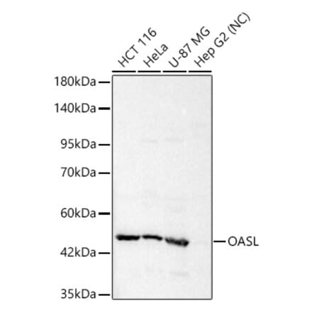 Western Blot - Anti-OASL Antibody (A329693) - Antibodies.com