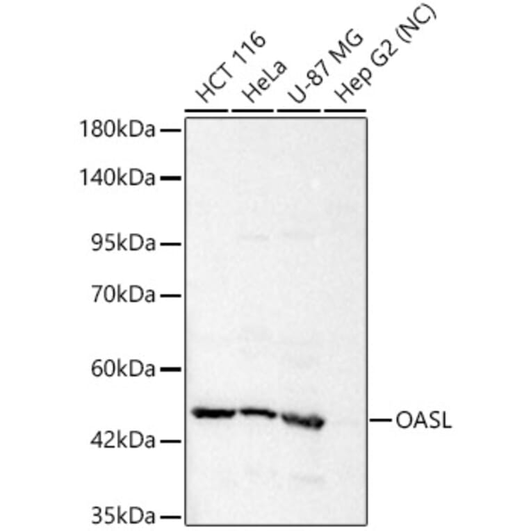 Western Blot - Anti-OASL Antibody (A329693) - Antibodies.com