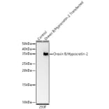 Western Blot - Anti-Orexin Antibody (A329696) - Antibodies.com