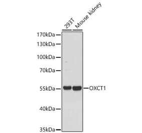 Western Blot - Anti-OXCT1 Antibody (A329697) - Antibodies.com