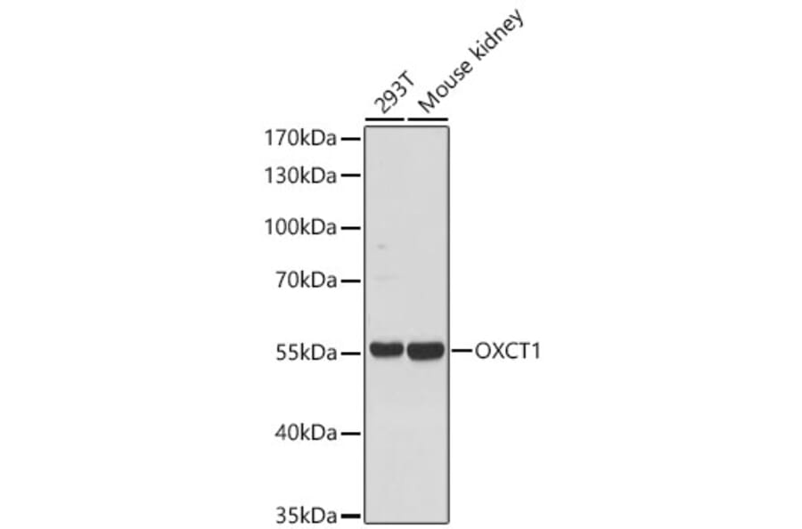 Western Blot - Anti-OXCT1 Antibody (A329697) - Antibodies.com