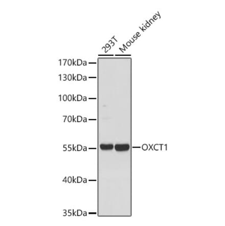 Western Blot - Anti-OXCT1 Antibody (A329697) - Antibodies.com