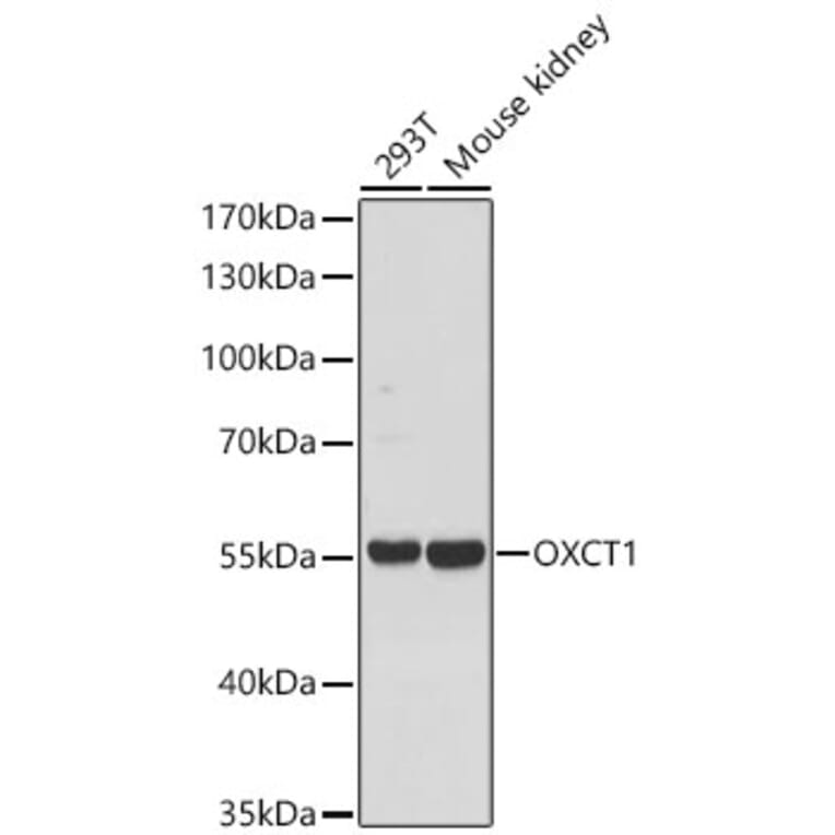 Western Blot - Anti-OXCT1 Antibody (A329697) - Antibodies.com