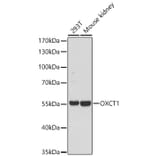 Western Blot - Anti-OXCT1 Antibody (A329697) - Antibodies.com