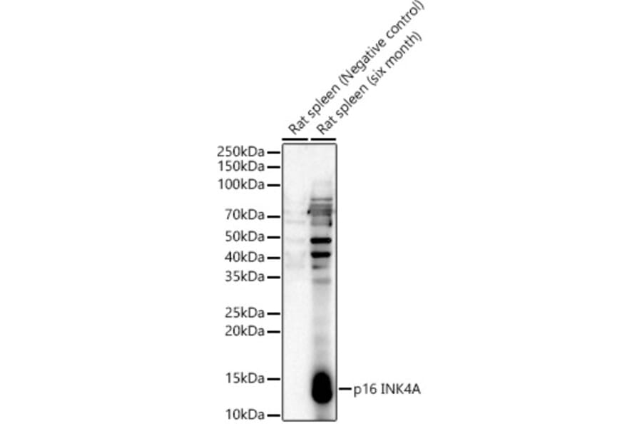 Western Blot - Anti-p16 INK4A Antibody (A329698) - Antibodies.com