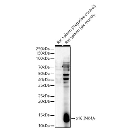 Western Blot - Anti-p16 INK4A Antibody (A329698) - Antibodies.com