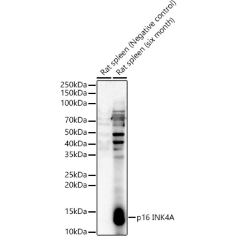 Western Blot - Anti-p16 INK4A Antibody (A329698) - Antibodies.com