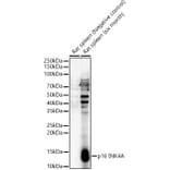 Western Blot - Anti-p16 INK4A Antibody (A329698) - Antibodies.com