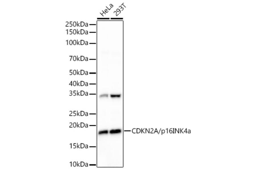 Western Blot - Anti-p16INK4a Antibody [ARC51033] (A329699) - Antibodies.com