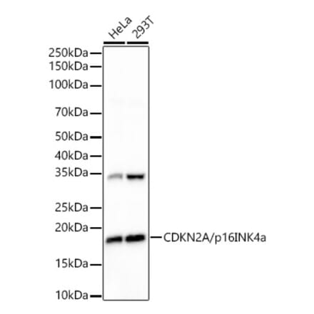 Western Blot - Anti-p16INK4a Antibody [ARC51033] (A329699) - Antibodies.com