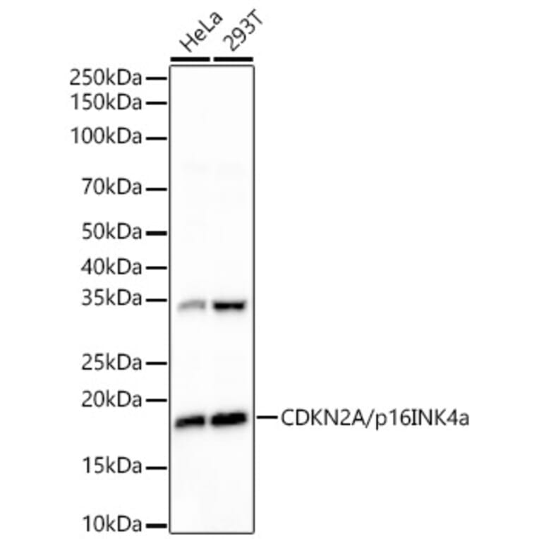 Western Blot - Anti-p16INK4a Antibody [ARC51033] (A329699) - Antibodies.com