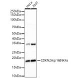 Western Blot - Anti-p16INK4a Antibody [ARC51033] (A329699) - Antibodies.com