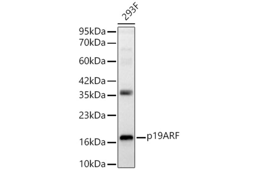 Western Blot - Anti-p19ARF Antibody (A329700) - Antibodies.com