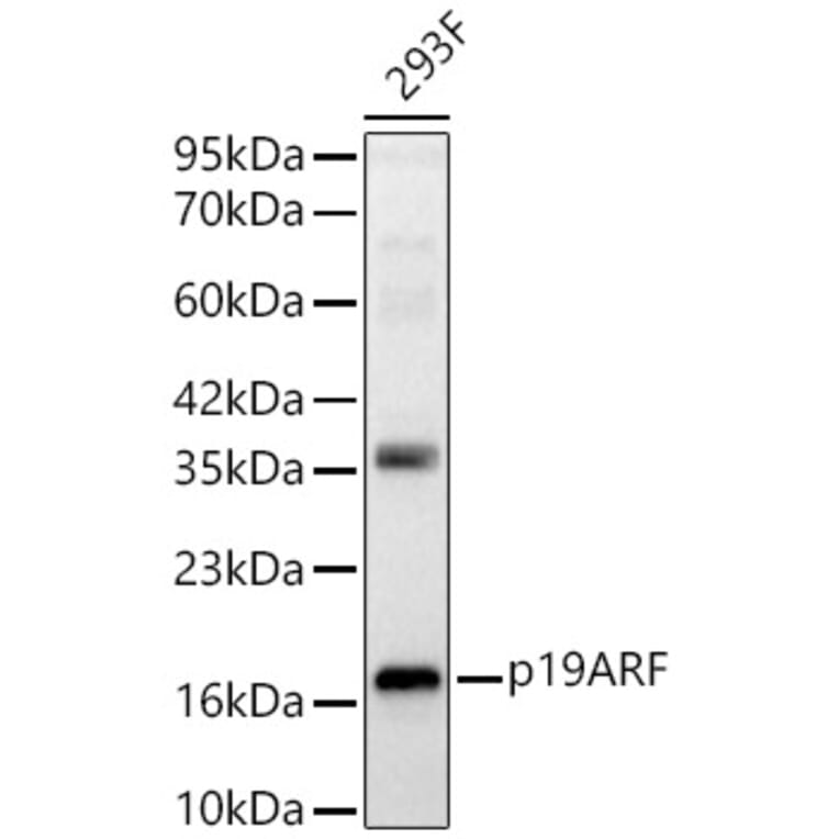 Western Blot - Anti-p19ARF Antibody (A329700) - Antibodies.com