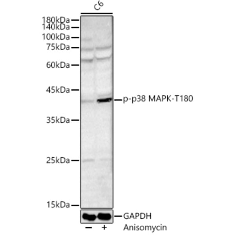 Western Blot - Anti-MAPK14 (Phospho T180) Antibody (A329704) - Antibodies.com