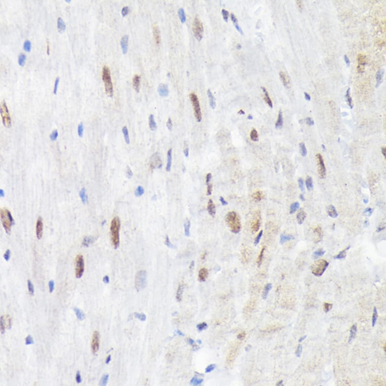 Immunohistochemistry - Anti-MAPK14 (Phospho T180) Antibody (A329704) - Antibodies.com