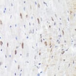 Immunohistochemistry - Anti-MAPK14 (Phospho T180) Antibody (A329704) - Antibodies.com