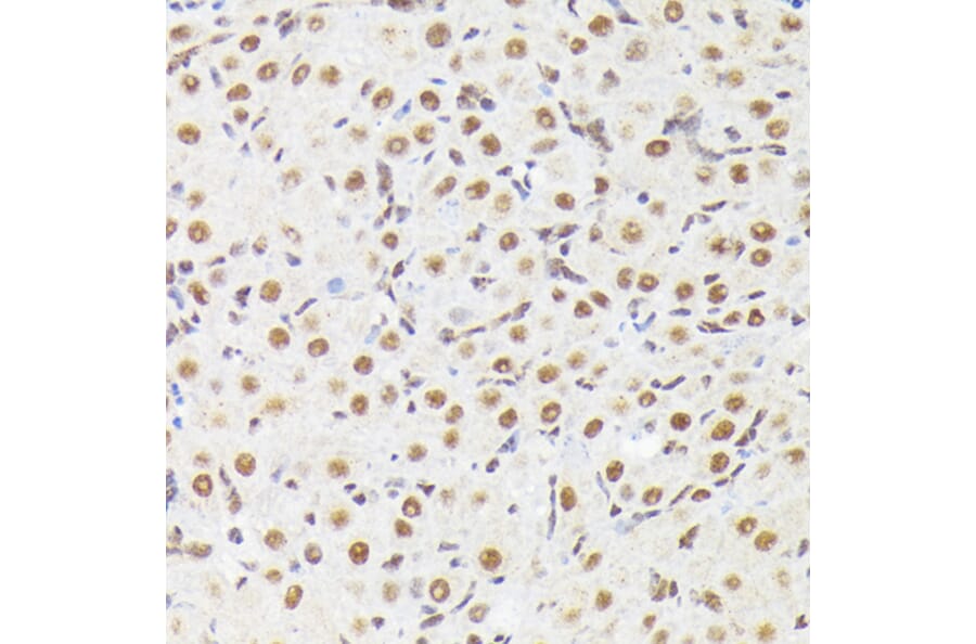 Immunohistochemistry - Anti-MAPK14 (Phospho T180) Antibody (A329704) - Antibodies.com