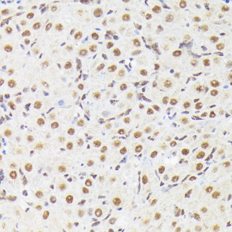 Immunohistochemistry - Anti-MAPK14 (Phospho T180) Antibody (A329704) - Antibodies.com