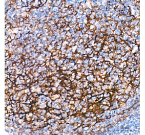 Immunohistochemistry - Anti-p75 NGF Receptor Antibody (A329705) - Antibodies.com