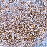 Immunohistochemistry - Anti-p75 NGF Receptor Antibody (A329705) - Antibodies.com