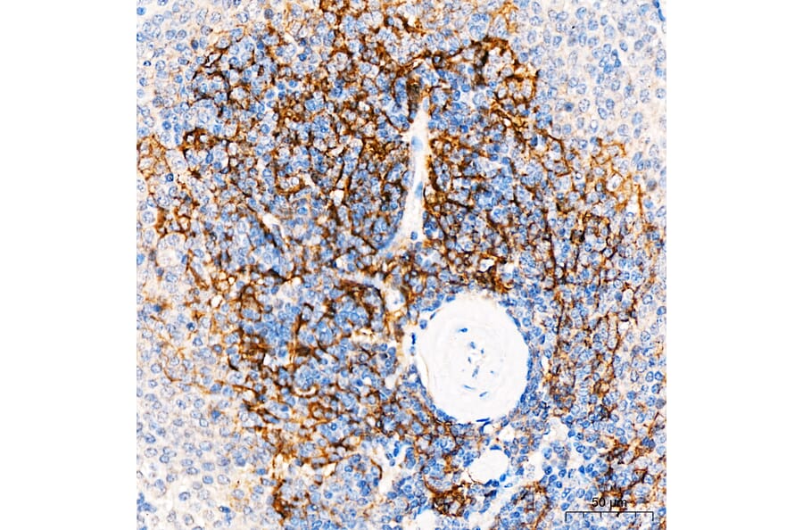 Immunohistochemistry - Anti-p75 NGF Receptor Antibody (A329706) - Antibodies.com
