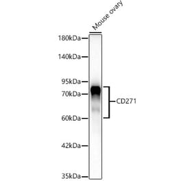 Western Blot - Anti-p75 NGF Receptor Antibody [ARC62149] (A329707) - Antibodies.com