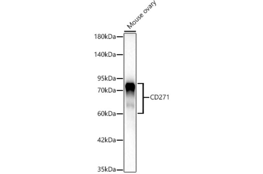 Western Blot - Anti-p75 NGF Receptor Antibody [ARC62149] (A329707) - Antibodies.com