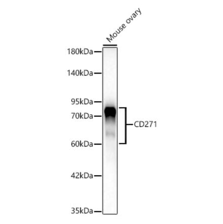 Western Blot - Anti-p75 NGF Receptor Antibody [ARC62149] (A329707) - Antibodies.com