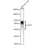 Western Blot - Anti-p75 NGF Receptor Antibody [ARC62149] (A329707) - Antibodies.com