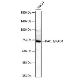 Western Blot - Anti-PADI1 Antibody [ARC61569] (A329708) - Antibodies.com