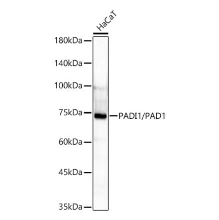 Western Blot - Anti-PADI1 Antibody [ARC61569] (A329708) - Antibodies.com