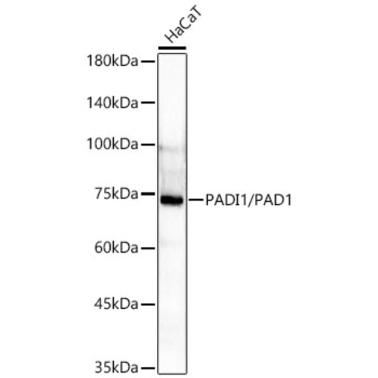Western Blot - Anti-PADI1 Antibody [ARC61569] (A329708) - Antibodies.com