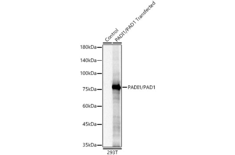 Western Blot - Anti-PADI1 Antibody [ARC61569] (A329708) - Antibodies.com