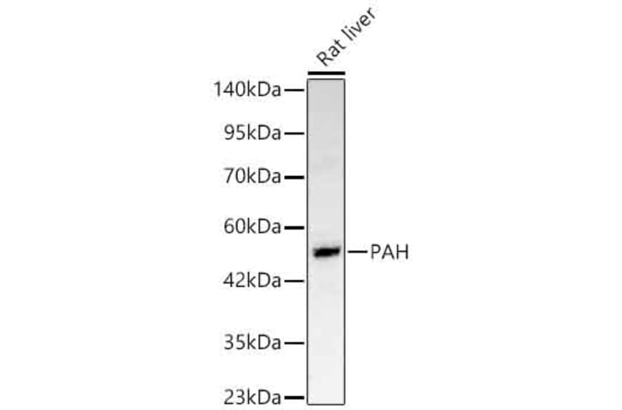 Western Blot - Anti-PAH Antibody (A329710) - Antibodies.com