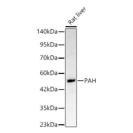 Western Blot - Anti-PAH Antibody (A329710) - Antibodies.com