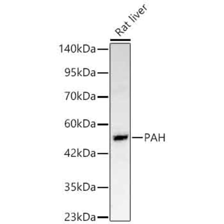 Western Blot - Anti-PAH Antibody (A329710) - Antibodies.com