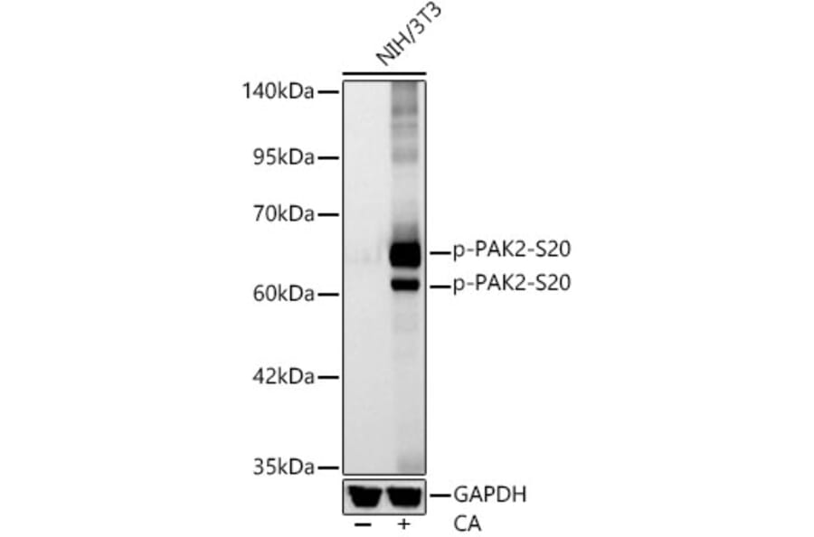 Western Blot - Anti-PAK2 (Phospho S20) Antibody [ARC62567] (A329711) - Antibodies.com