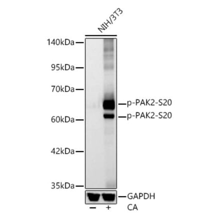 Western Blot - Anti-PAK2 (Phospho S20) Antibody [ARC62567] (A329711) - Antibodies.com