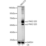 Western Blot - Anti-PAK2 (Phospho S20) Antibody [ARC62567] (A329711) - Antibodies.com