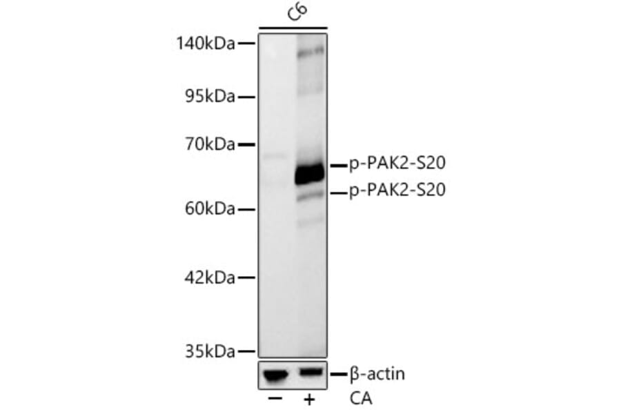 Western Blot - Anti-PAK2 (Phospho S20) Antibody [ARC62567] (A329711) - Antibodies.com