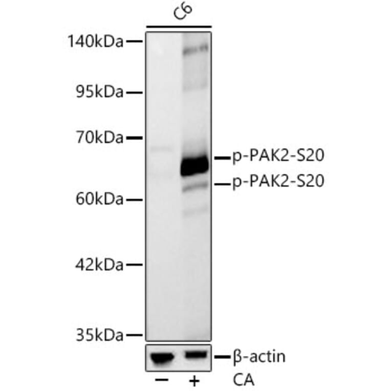 Western Blot - Anti-PAK2 (Phospho S20) Antibody [ARC62567] (A329711) - Antibodies.com