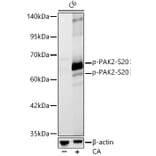 Western Blot - Anti-PAK2 (Phospho S20) Antibody [ARC62567] (A329711) - Antibodies.com