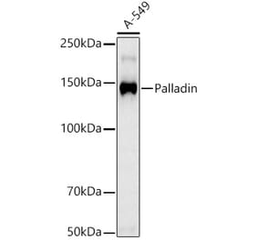 Western Blot - Anti-Palladin Antibody [ARC3132] (A329712) - Antibodies.com