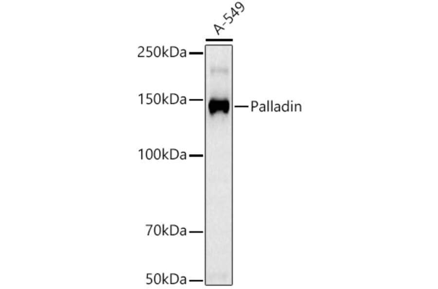 Western Blot - Anti-Palladin Antibody [ARC3132] (A329712) - Antibodies.com