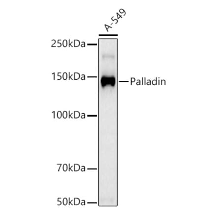 Western Blot - Anti-Palladin Antibody [ARC3132] (A329712) - Antibodies.com