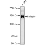 Western Blot - Anti-Palladin Antibody [ARC3132] (A329712) - Antibodies.com