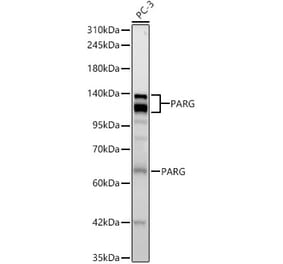 Western Blot - Anti-PARG Antibody [ARC63810] (A329715) - Antibodies.com