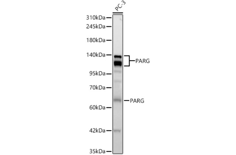 Western Blot - Anti-PARG Antibody [ARC63810] (A329715) - Antibodies.com