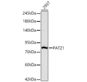 Western Blot - Anti-PATZ1 Antibody [ARC67668] (A329717) - Antibodies.com
